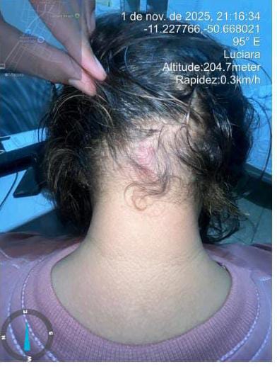 MULHER RELATA AGRESSÃO DO COMPANHEIRO E PEDE MEDIDA PROTETIVA APÓS DISCUSSÃO POR CIÚMES.